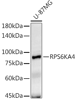 RPS6KA4 Rabbit Polyclonal Antibody