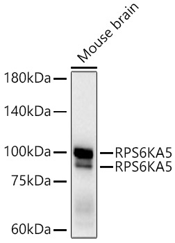 RPS6KA5 Rabbit Monoclonal Antibody - Image 2