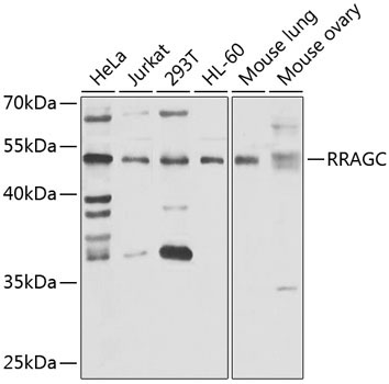 RRAGC Rabbit Polyclonal Antibody