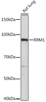 RRM1 Rabbit Monoclonal Antibody - Image 2