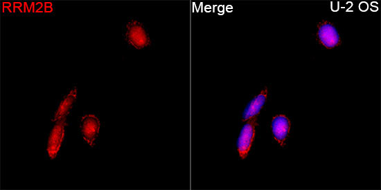RRM2B Rabbit Polyclonal Antibody
