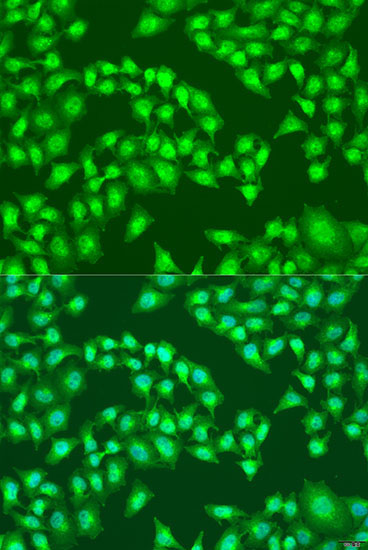 RSAD2 Rabbit Polyclonal Antibody - Image 2
