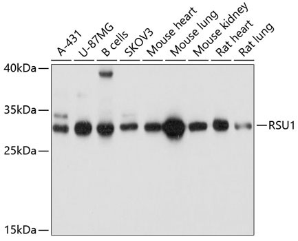 RSU1 Rabbit Polyclonal Antibody