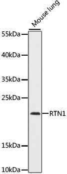 RTN1 Rabbit Polyclonal Antibody