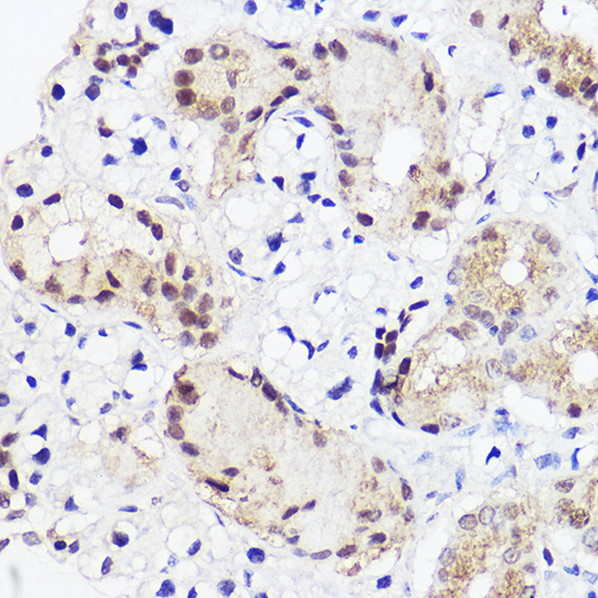 RUNX2 Rabbit Polyclonal Antibody - Image 3