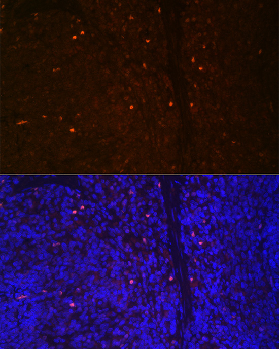 RUNX2 Rabbit Polyclonal Antibody - Image 4