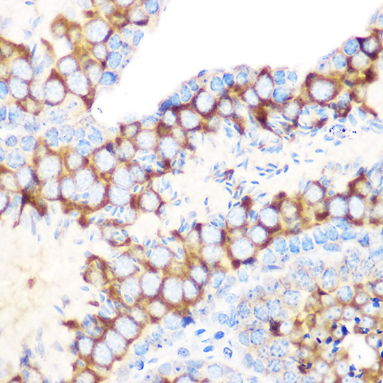 RUVBL1/TIP49A/PONTIN Rabbit Monoclonal Antibody - Image 2
