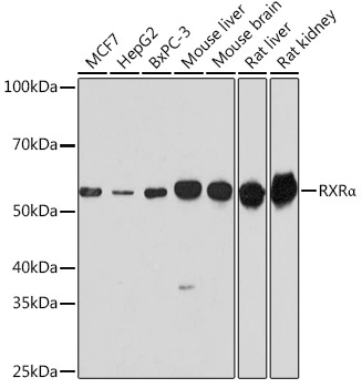RXRAlpha Rabbit Polyclonal Antibody