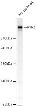 RYR2 Rabbit Polyclonal Antibody