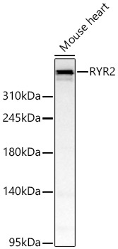 RYR2 Rabbit Polyclonal Antibody