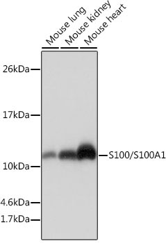 S100/S100A1 Rabbit Monoclonal Antibody