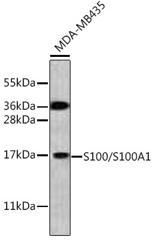 S100/S100A1 Rabbit Polyclonal Antibody