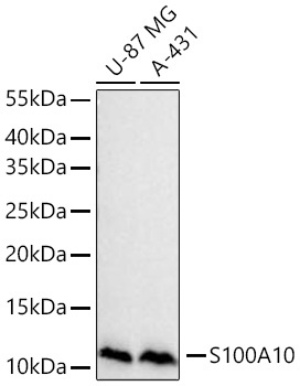 S100A10 Rabbit Monoclonal Antibody
