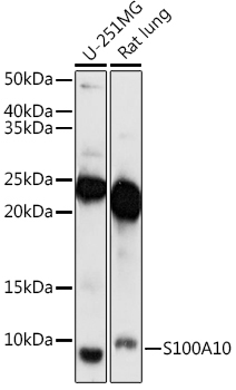 S100A10 Rabbit Polyclonal Antibody