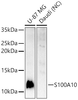 S100A10 Rabbit Polyclonal Antibody