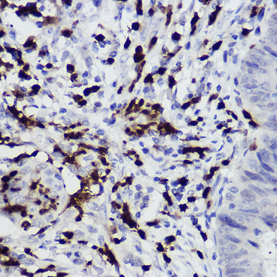 S100A12 Rabbit Polyclonal Antibody