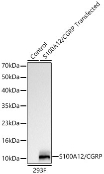S100A12/CGRP Rabbit Monoclonal Antibody