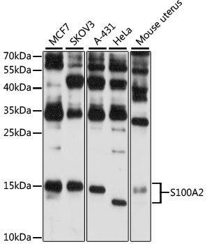 S100A2 Rabbit Polyclonal Antibody
