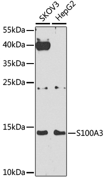 S100A3 Rabbit Polyclonal Antibody