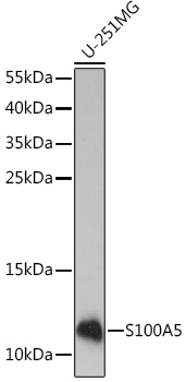 S100A5 Rabbit Polyclonal Antibody