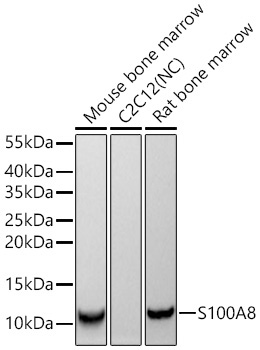 S100A8 Rabbit Monoclonal Antibody