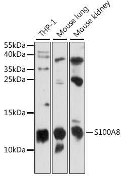 S100A8 Rabbit Polyclonal Antibody