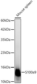 S100a9 Rabbit Polyclonal Antibody