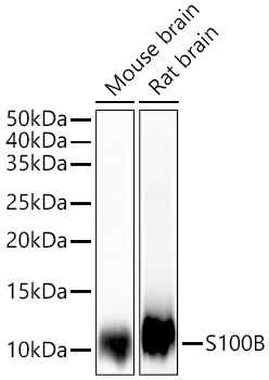 S100B Rabbit Monoclonal Antibody