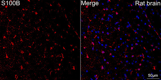 S100B Rabbit Monoclonal Antibody - Image 8