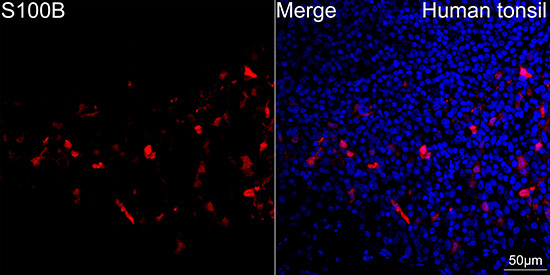 S100B Rabbit Monoclonal Antibody - Image 11