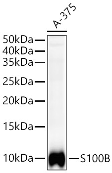 S100B Rabbit Monoclonal Antibody - Image 12