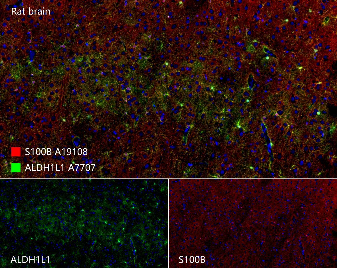 S100B Rabbit Monoclonal Antibody - Image 13