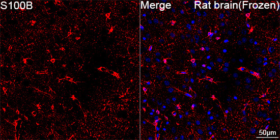 S100B Rabbit Monoclonal Antibody - Image 15