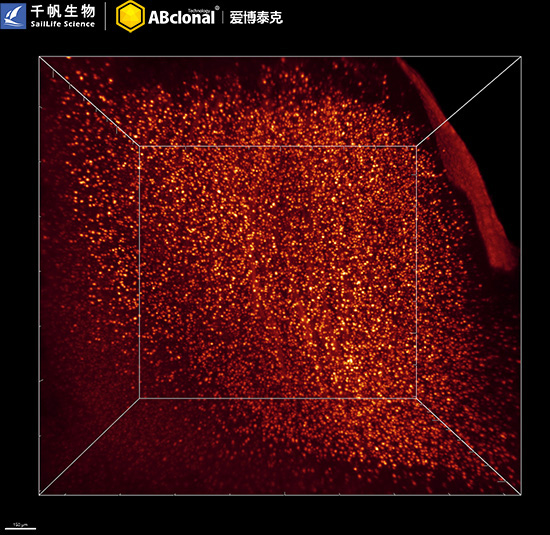 S100B Rabbit Monoclonal Antibody - Image 16