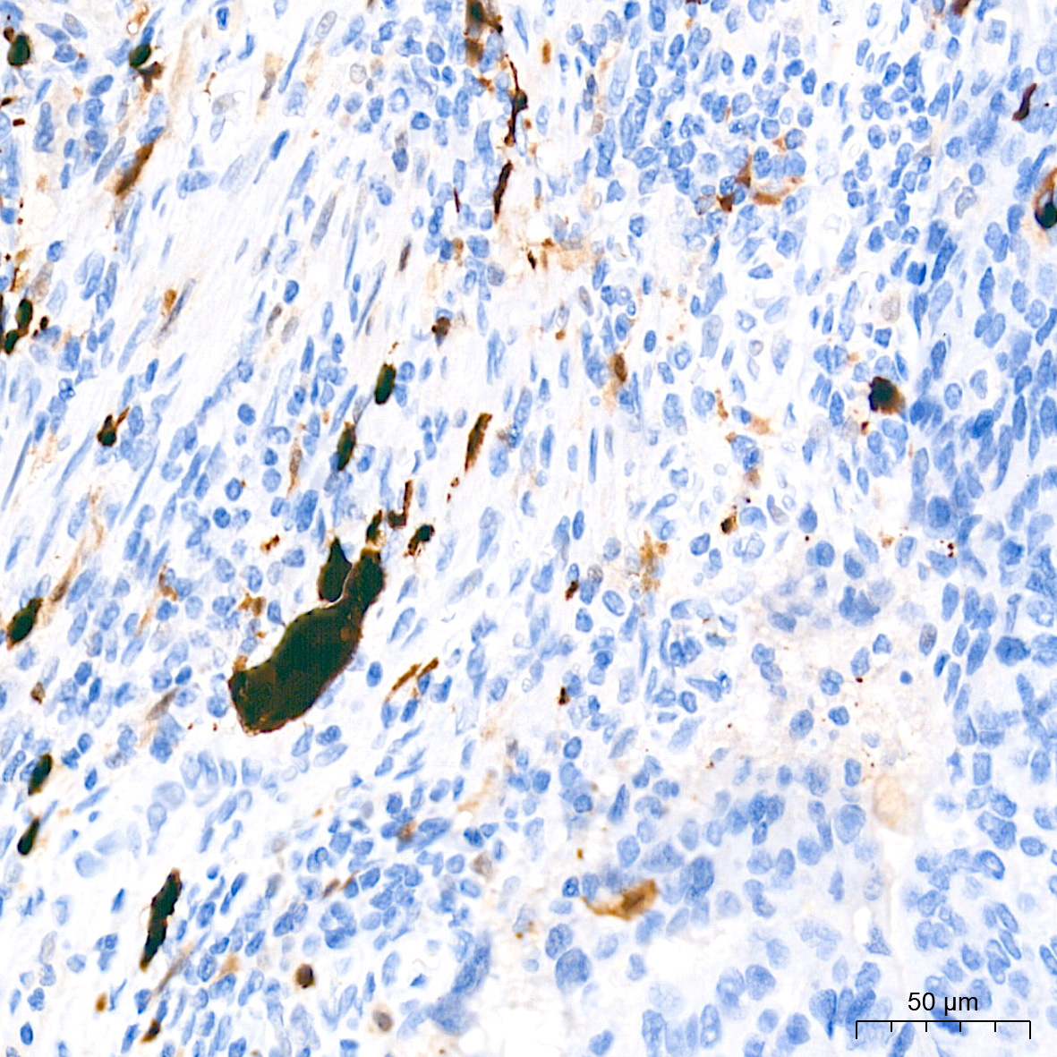 S100B Rabbit Monoclonal Antibody - Image 18