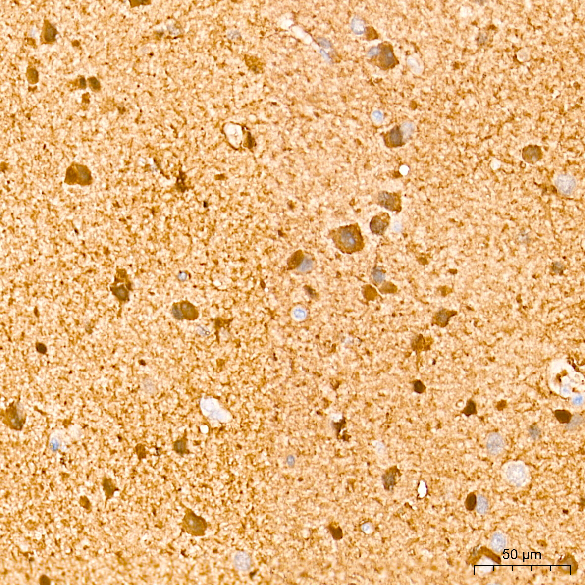 S100B Rabbit Monoclonal Antibody - Image 19