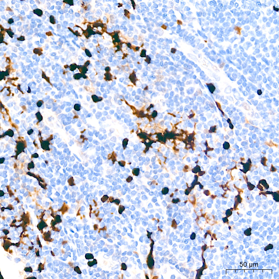 S100B Rabbit Monoclonal Antibody - Image 20