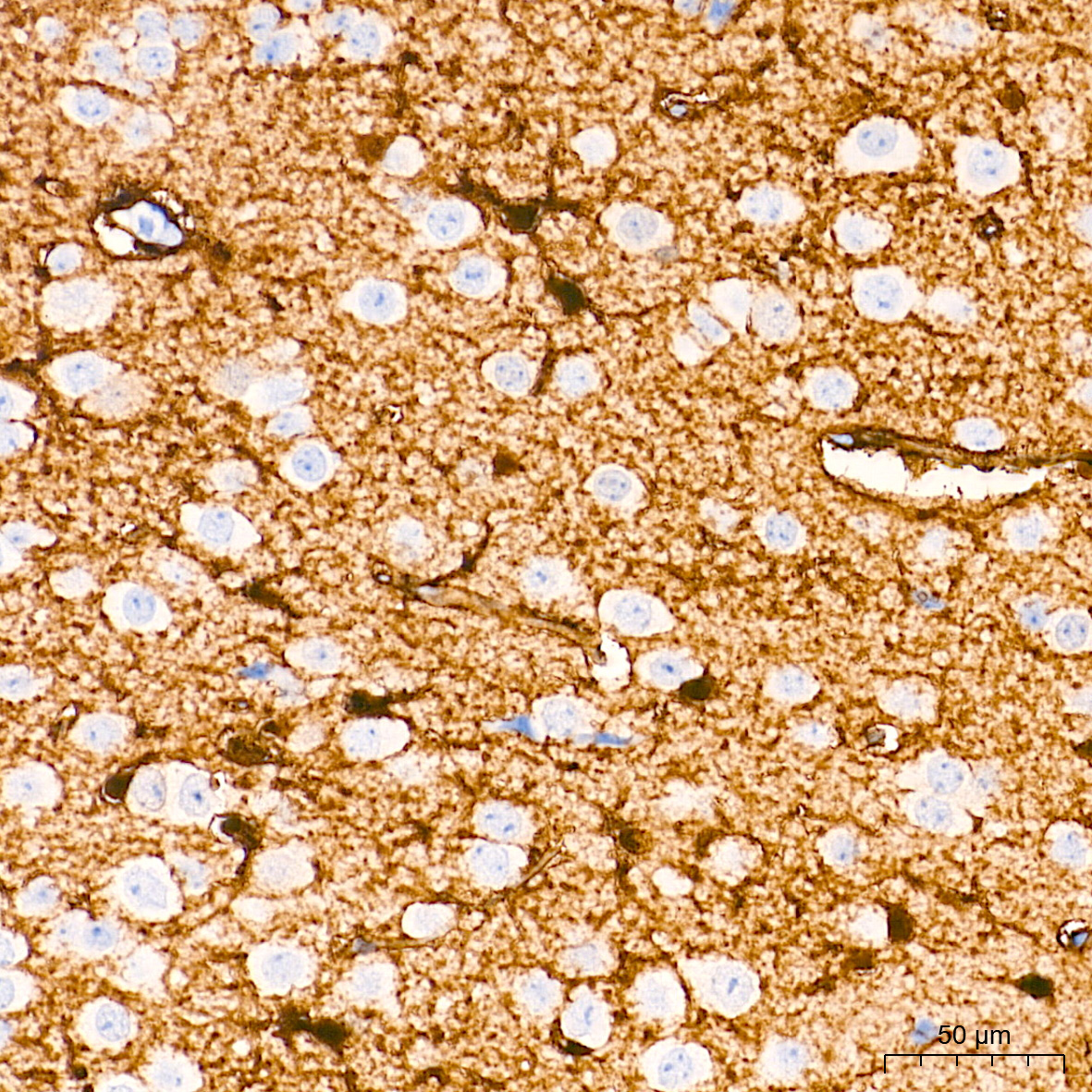 S100B Rabbit Monoclonal Antibody - Image 21