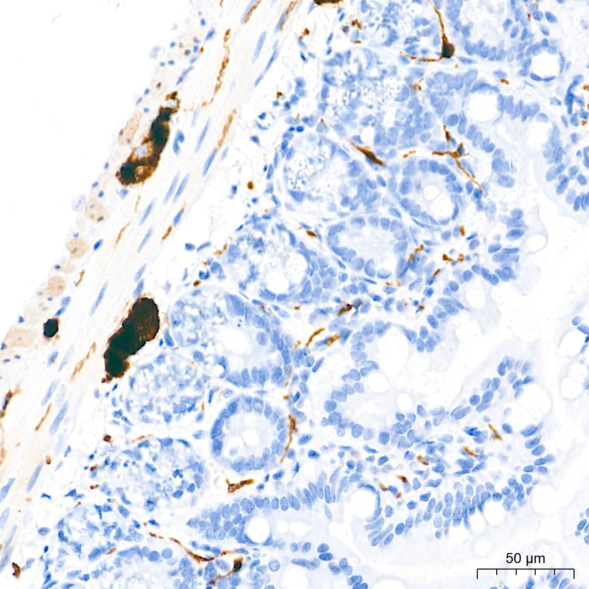 S100B Rabbit Monoclonal Antibody - Image 22
