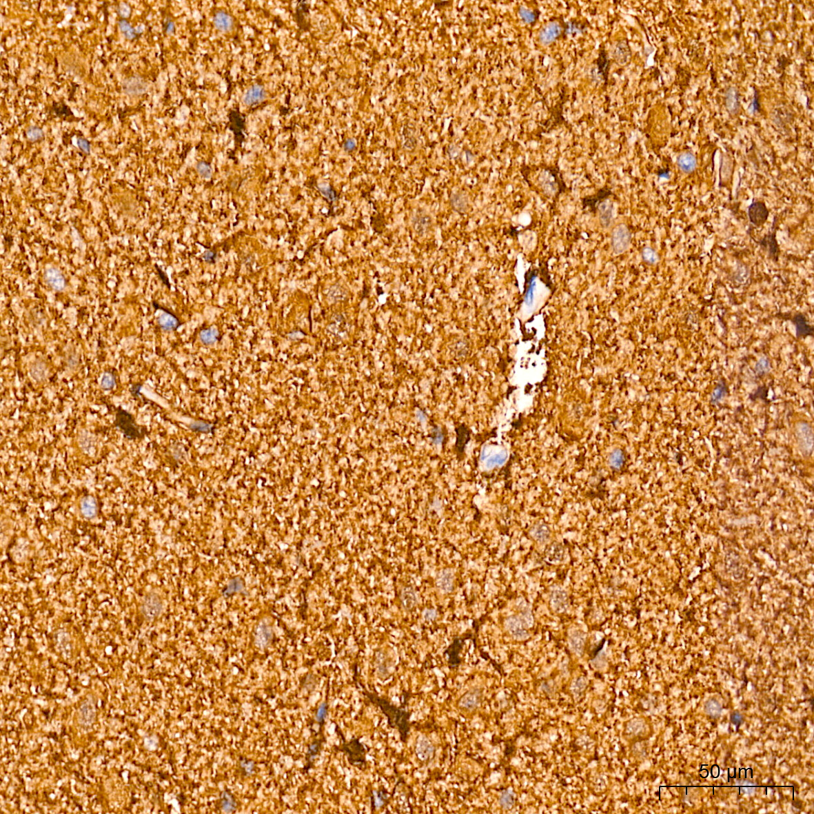 S100B Rabbit Monoclonal Antibody - Image 23