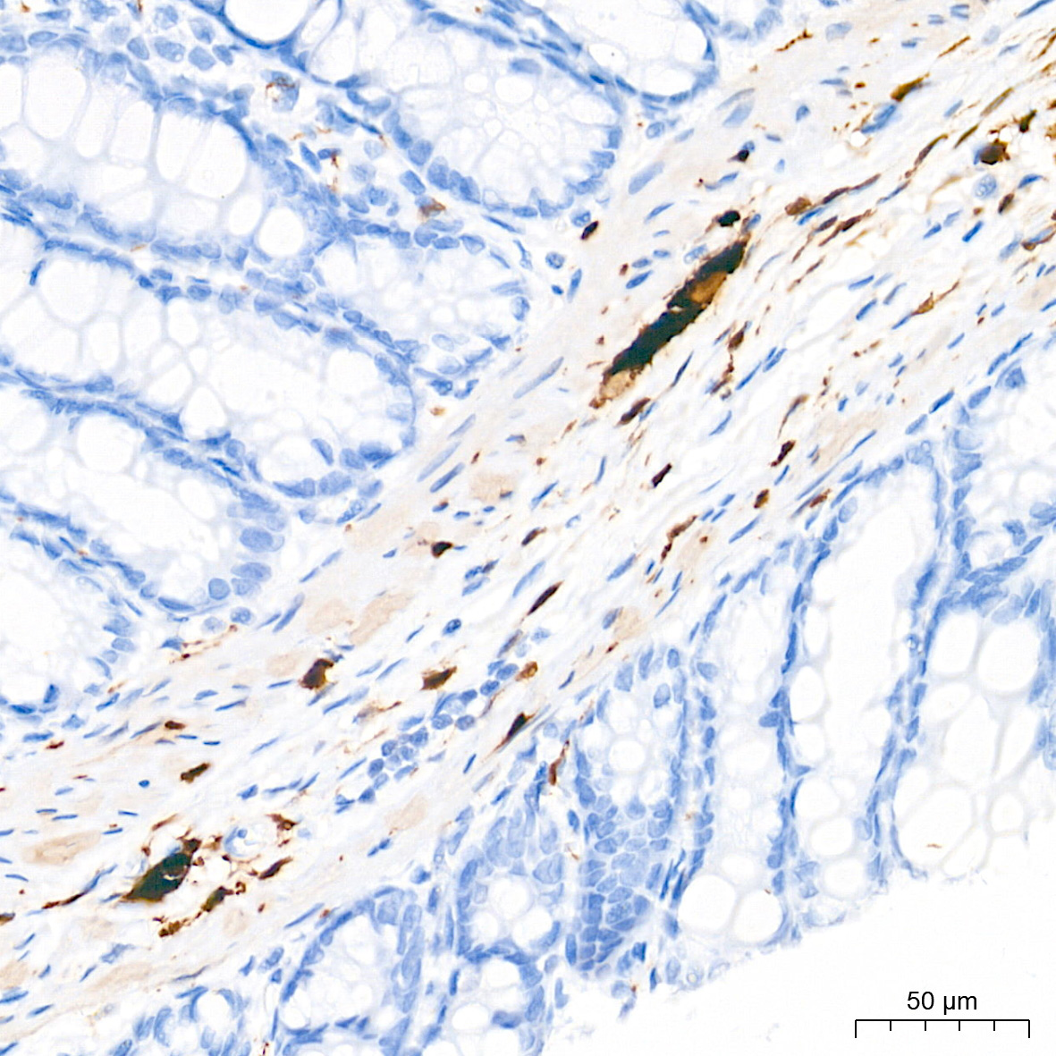 S100B Rabbit Monoclonal Antibody - Image 24