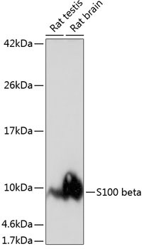 S100B Rabbit Monoclonal Antibody