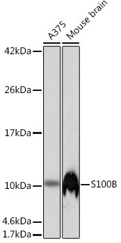 S100B Rabbit Monoclonal Antibody - Image 2
