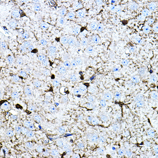 S100B Rabbit Monoclonal Antibody - Image 5