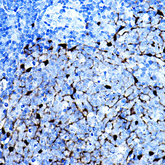 S100B Rabbit Monoclonal Antibody - Image 6