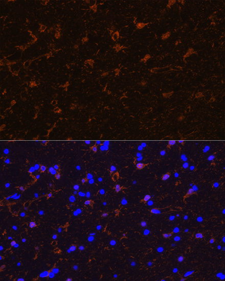 S100B Rabbit Monoclonal Antibody - Image 7