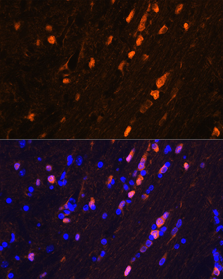 S100B Rabbit Monoclonal Antibody - Image 8