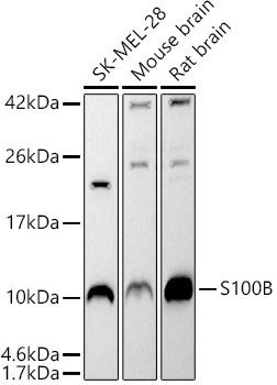 S100B Rabbit Polyclonal Antibody