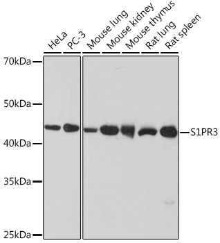 S1PR3 Rabbit Monoclonal Antibody