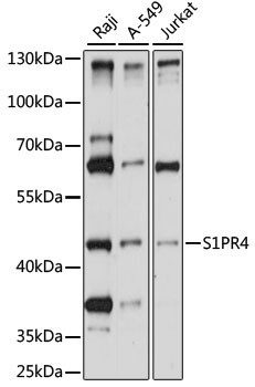 S1PR4 Rabbit Polyclonal Antibody